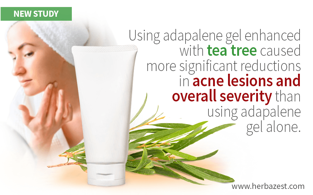 Study Shows Benefits of Tea Tree Oil for Acne