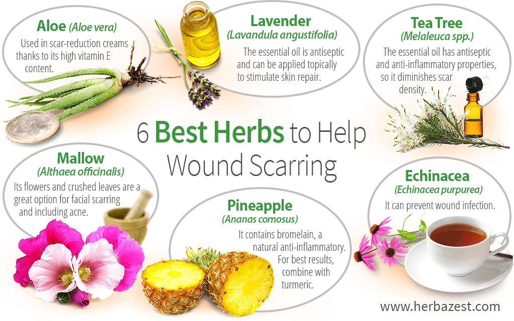 6 Best Herbs to Help Wound Scarring