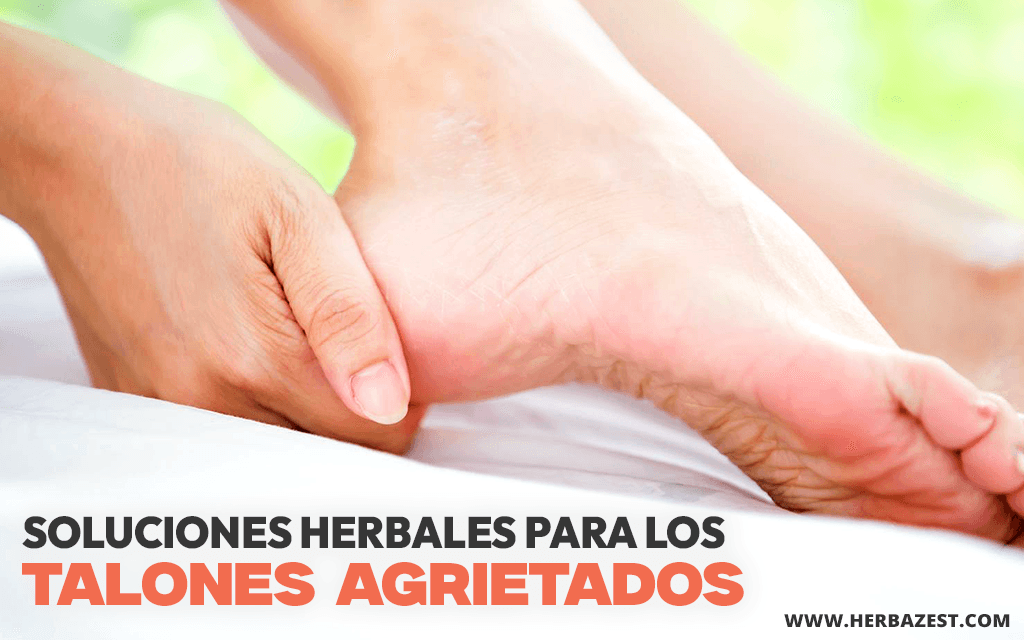 Soluciones herbales para los talones agrietados