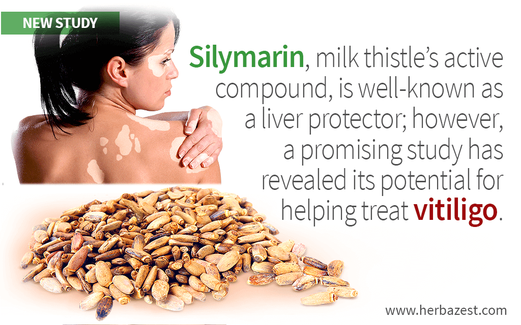 Silymarin, Milk Thistle's Active Compound, Proven Useful for Treating Vitiligo